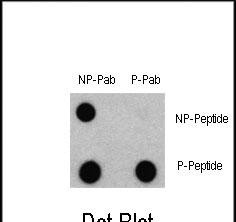 Phospho-LC3C(S12)