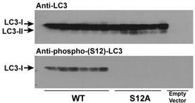 Rabbit Polyclonal Antibody to Phospho-LC3C(S12)