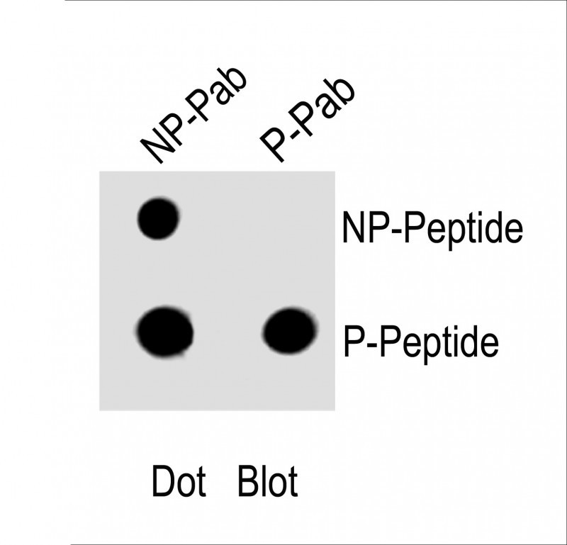 Rabbit Polyclonal Antibody to Phospho-PI3KC3(S676)