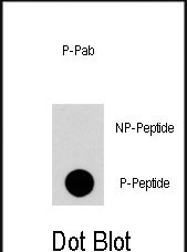 Phospho-RGS19(S24)