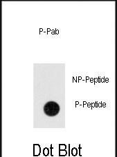 Phospho-ANTXR1(Y382)