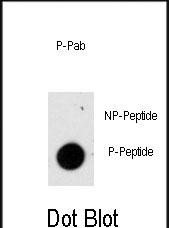 Phospho-GFAP(S8)