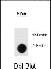 Phospho-Leo1(S551)
