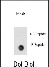Phospho-PBK(Y74)