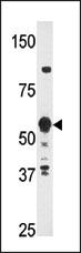 HDBP2(HDRF-2)