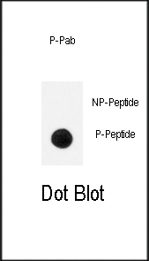 Phospho-TrkA(Y791)