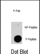 Phospho-TSC2(S939)