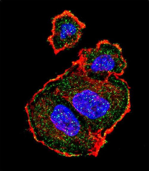 Rabbit Polyclonal Antibody to Phospho-TSC2(S939)