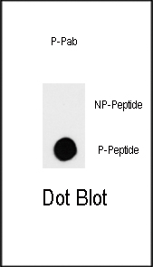 Phospho-TSC2(S664)