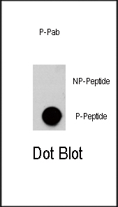 Phospho-AKT3(S472)