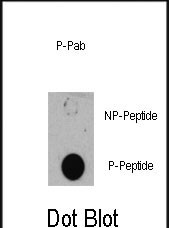 Phospho-TSC1(S505)