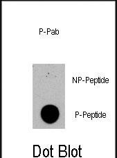 Phospho-TSC2(S1420)