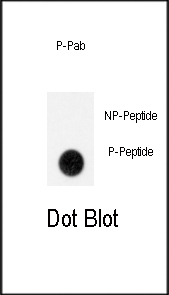 Phospho-GIT1(Y554)