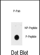 Phospho-INSR(Y1185)