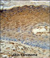 Rabbit Polyclonal Antibody to AK7