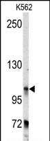 BICD2