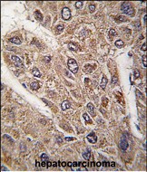 Rabbit Polyclonal Antibody to BICD2