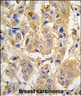 Rabbit Polyclonal Antibody to MIPEP