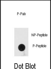 Phospho-PRKRA(S246)