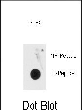 Phospho-MeCP2(S80)