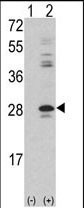 Rabbit Polyclonal Antibody to PRKCDBP