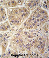 Rabbit Polyclonal Antibody to SARS2