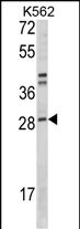 ITGB1BP3 (N-term)