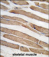 Rabbit Polyclonal Antibody to ITGB1BP3 (N-term)