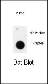 Phospho-ANTXR1(Y425)