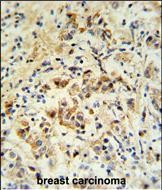 Rabbit Polyclonal Antibody to mouse BID (S61)