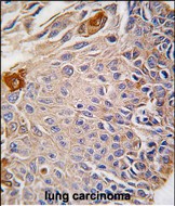 Rabbit Polyclonal Antibody to RMND5B