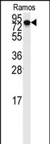 DLG7 (N-term)