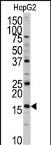 XTP3TPA (N-term)
