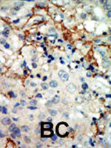 Rabbit Polyclonal Antibody to EphA3 (N-term)