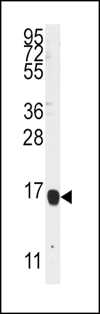 ALOX5AP