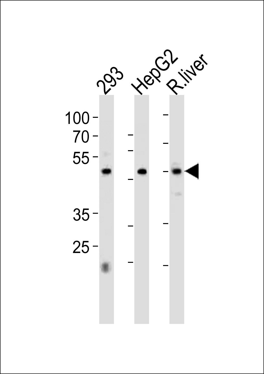 HNF4A