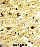 Rabbit Polyclonal Antibody to EXOSC8