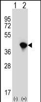 Rabbit Polyclonal Antibody to JTV1