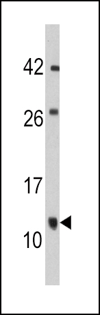 Rabbit Polyclonal Antibody to FKBP1B (N-term E6)