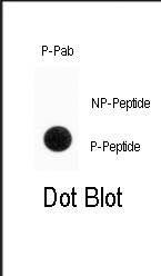 Phospho-ENT1(Slc29a1)(S254)