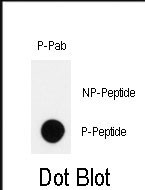Phospho-HIPK2(Y361)