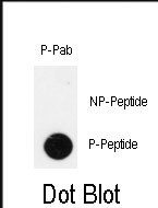 Phospho-IPF(T11)