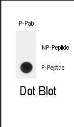 Phospho-TERT(Y707)