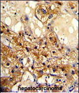 Rabbit Polyclonal Antibody to CYP20A1
