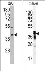 AKR7A2 (N-term)