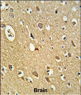 Rabbit Polyclonal Antibody to OMD