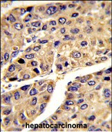 Rabbit Polyclonal Antibody to IGFALS
