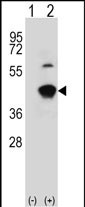 Rabbit Polyclonal Antibody to GCAT