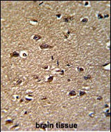 Rabbit Polyclonal Antibody to GCAT