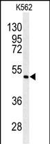 ANGPTL6